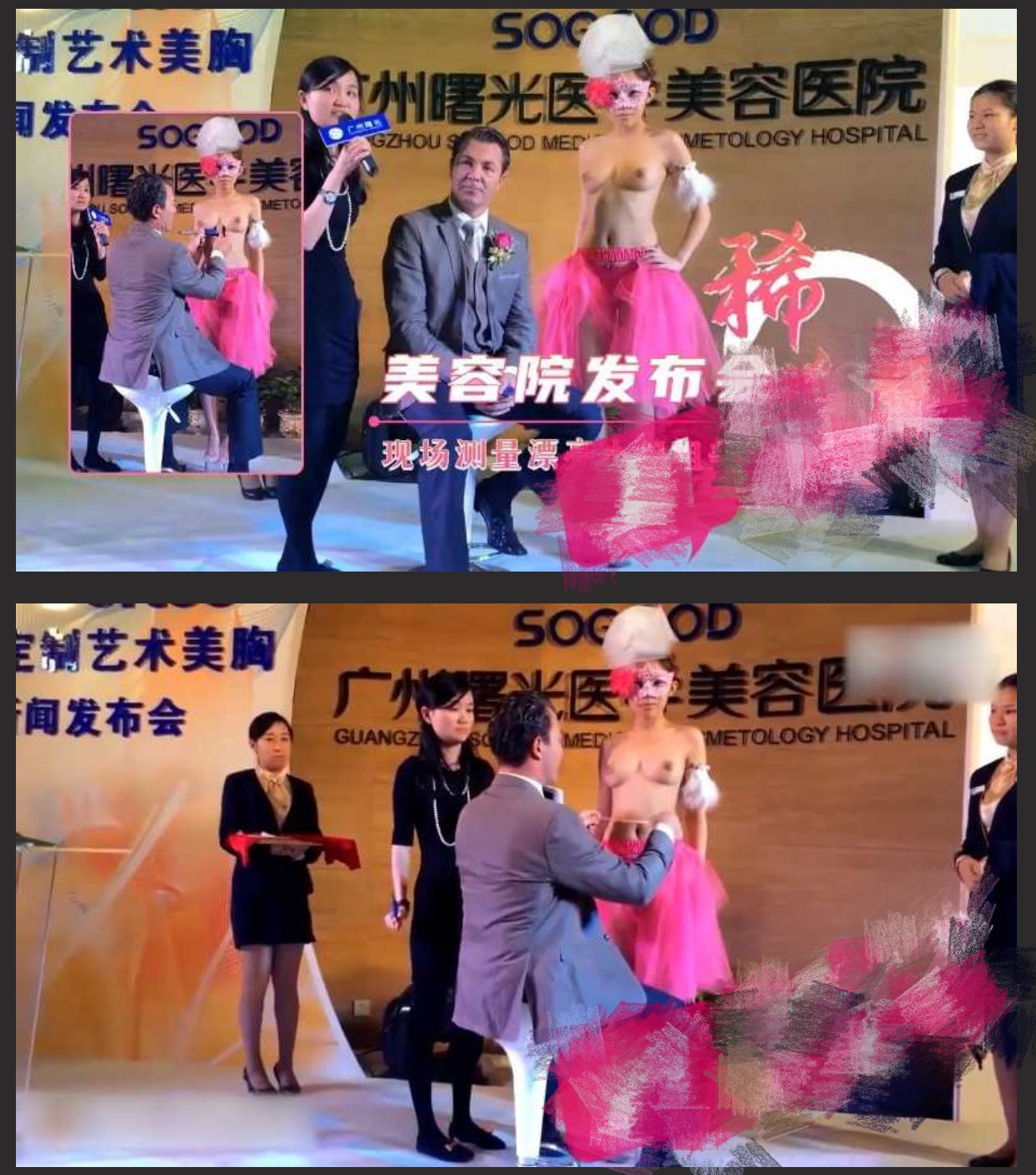 ❤️❤️❤️廣州曙光醫院美容醫院發布會脫光衣服露奶教學逐幀分析講解!