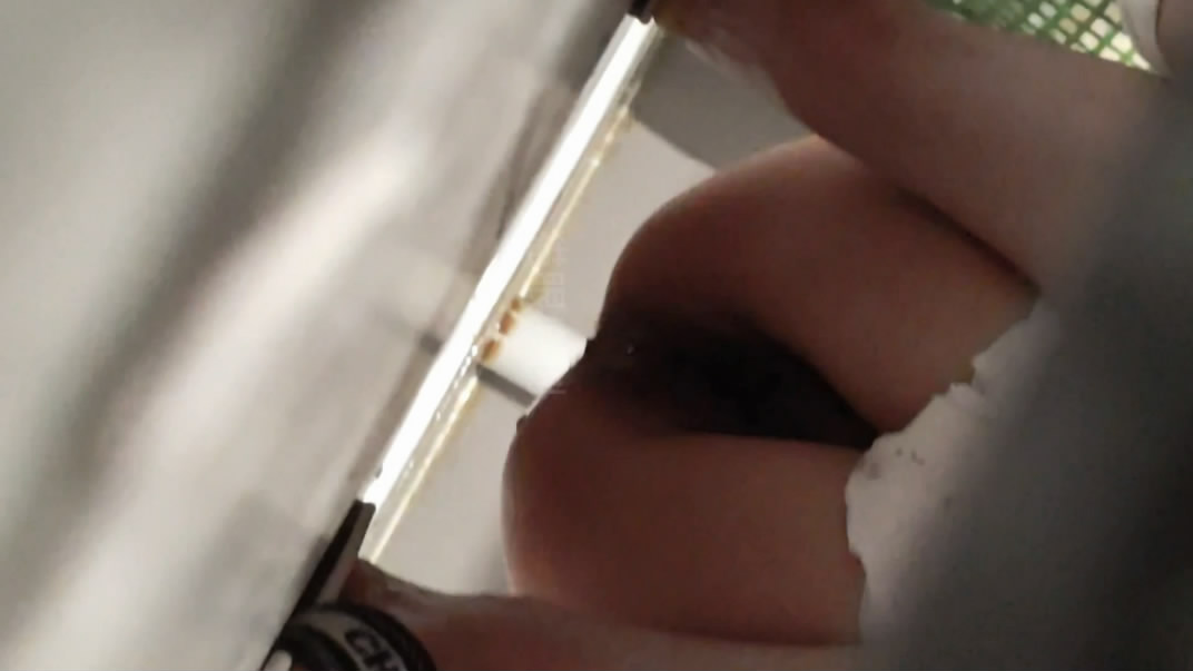 ❤️❤️❤️廣州曙光醫院美容醫院發布會脫光衣服露奶教學逐幀分析講解!